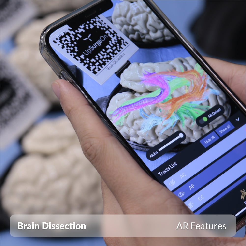 Brain Dissection
