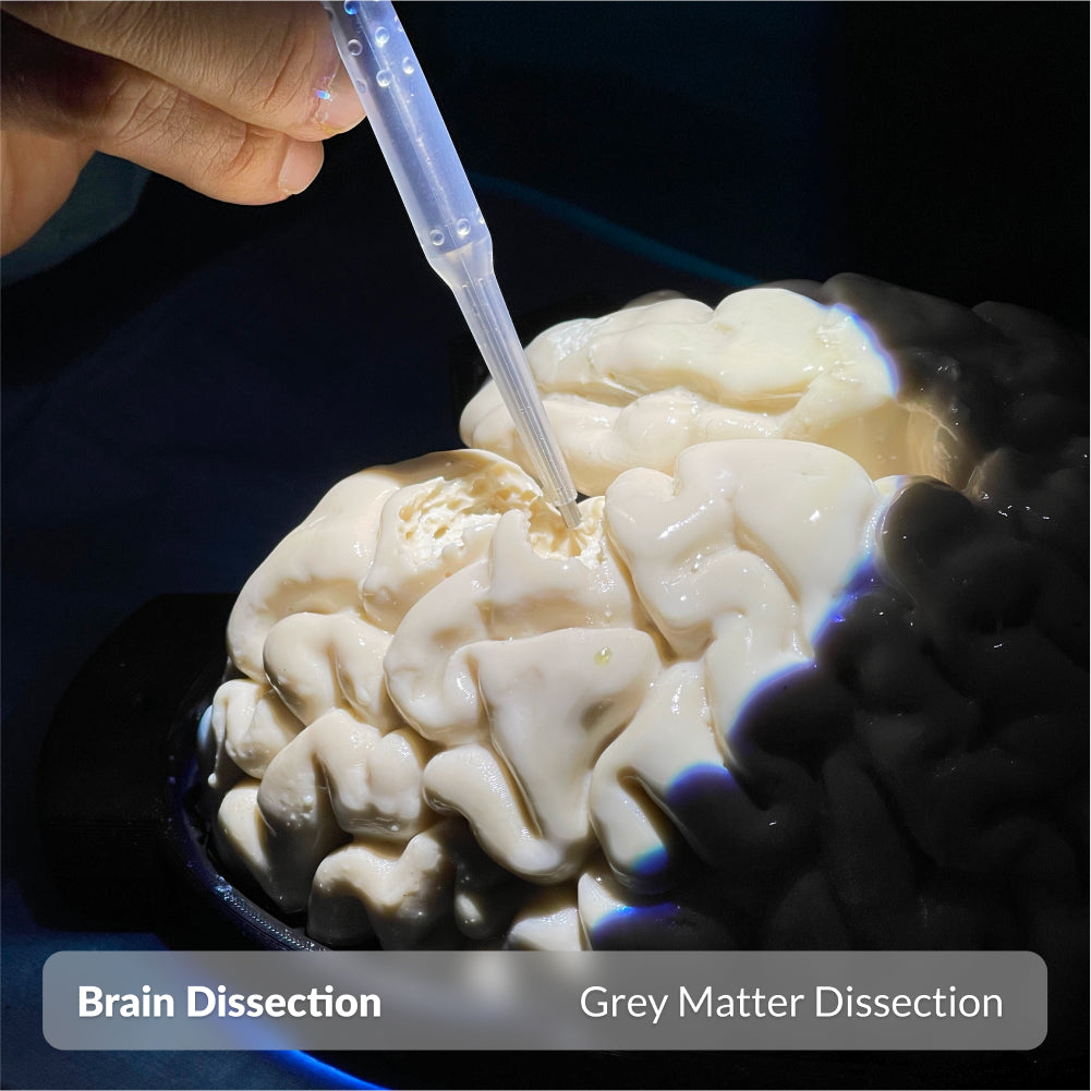 Brain Dissection