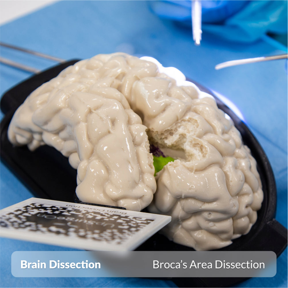 Brain Dissection