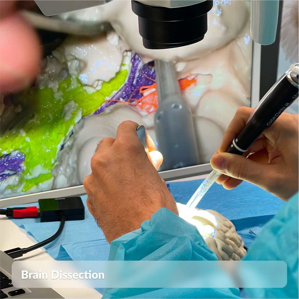Brain Dissection