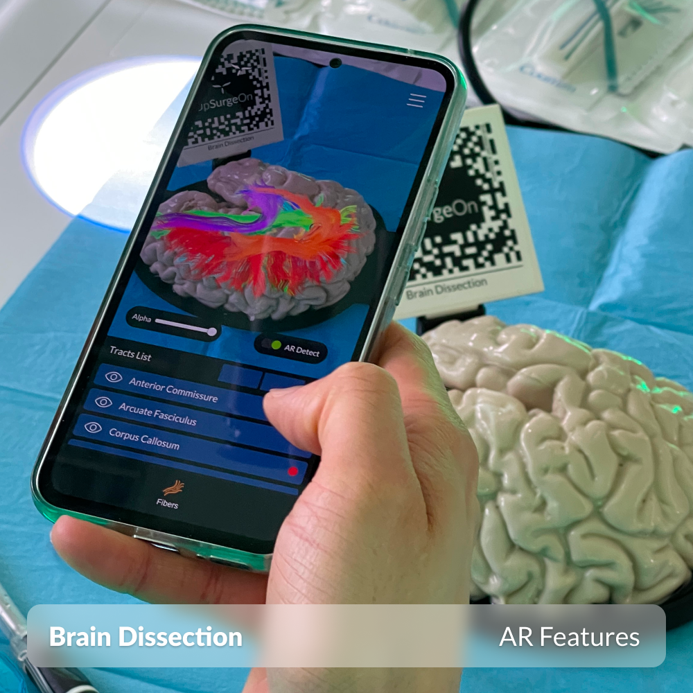 Brain Dissection