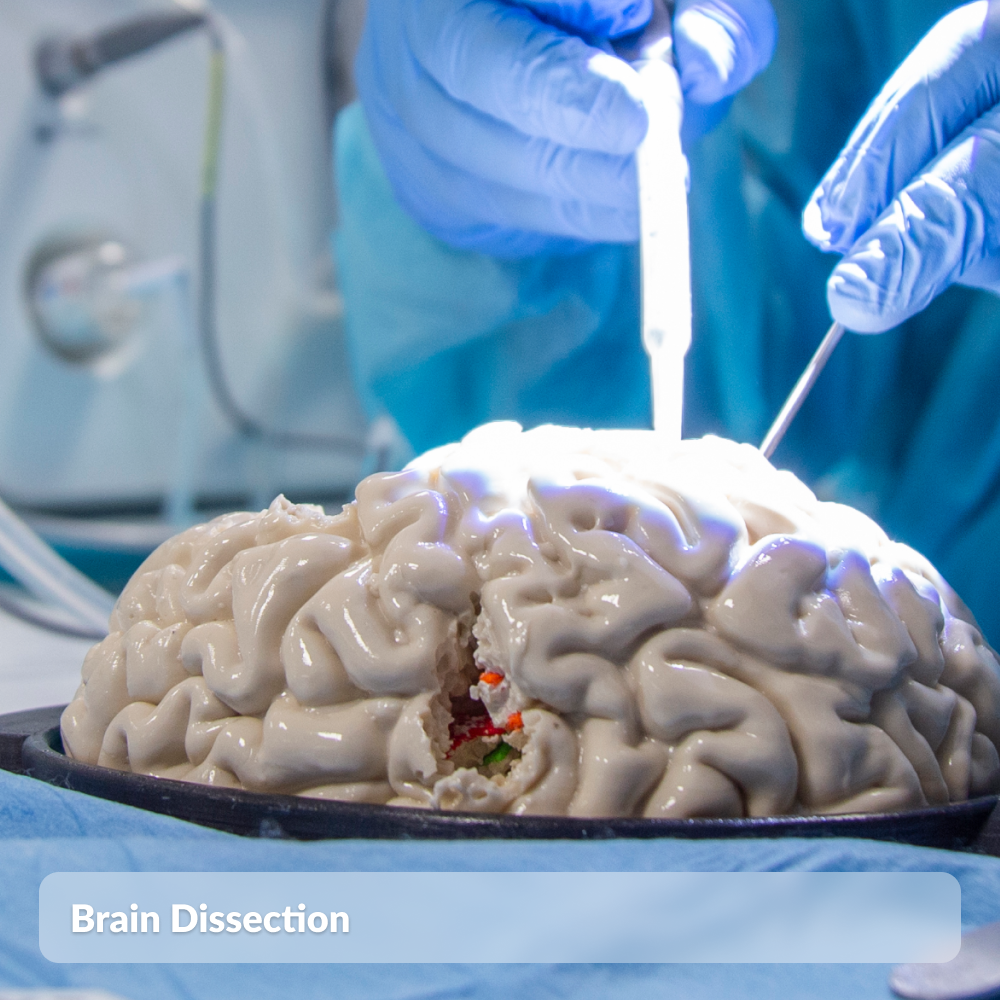 Brain Dissection
