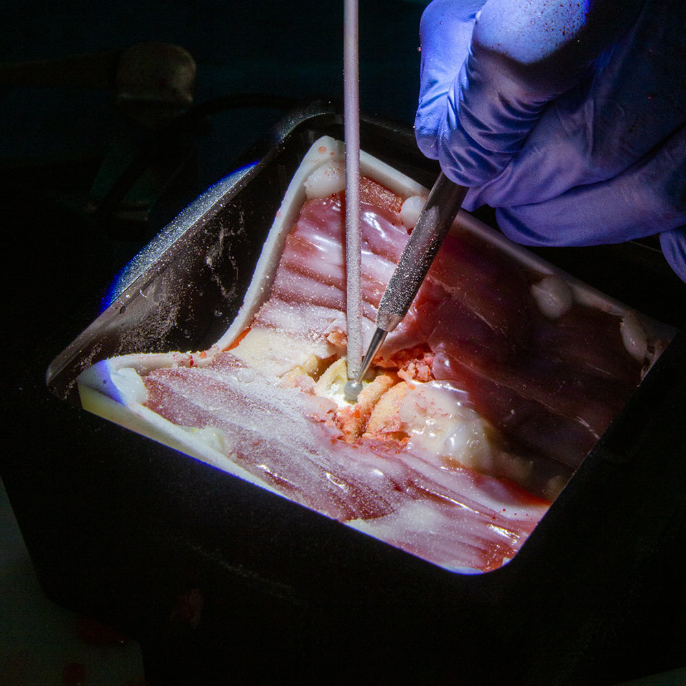 Anterior Cervical Box