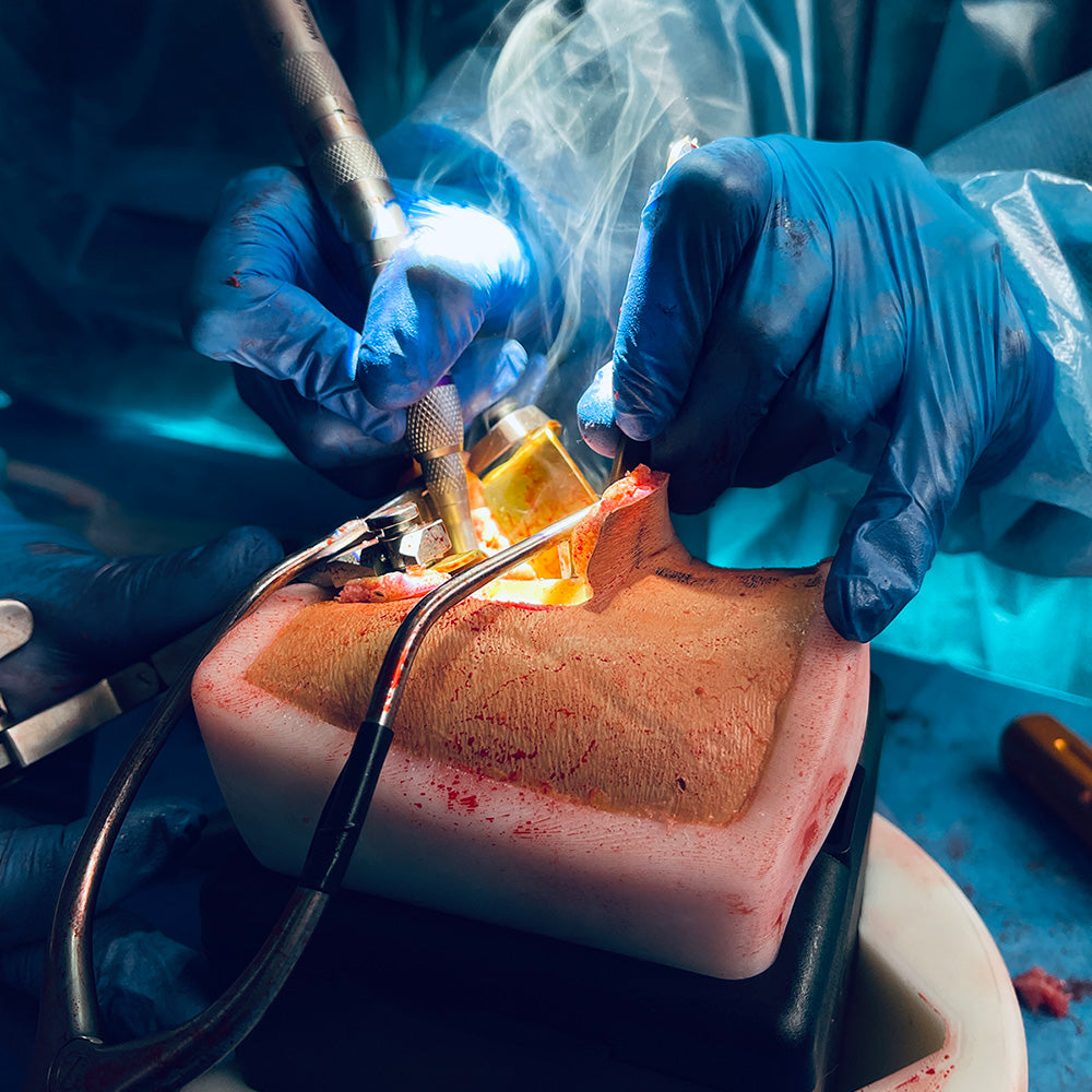 Anterior Cervical Box