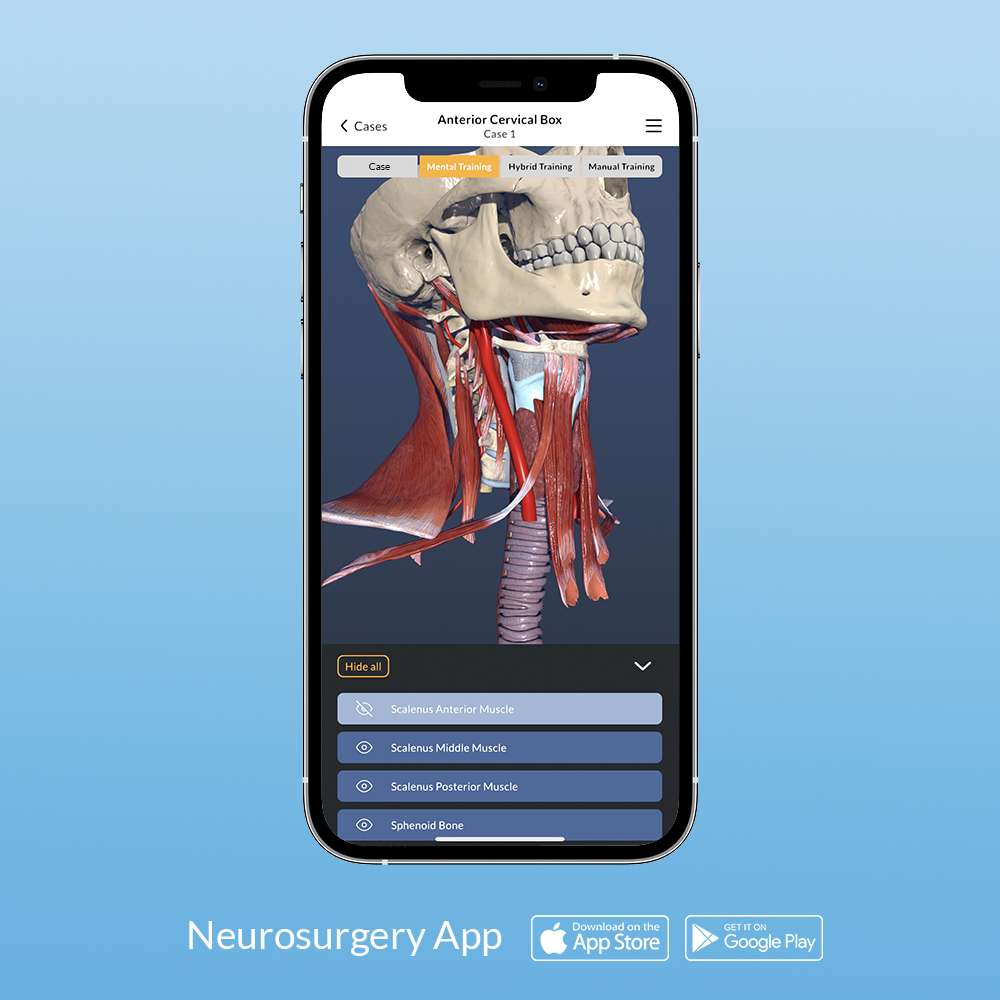 Anterior Cervical Box