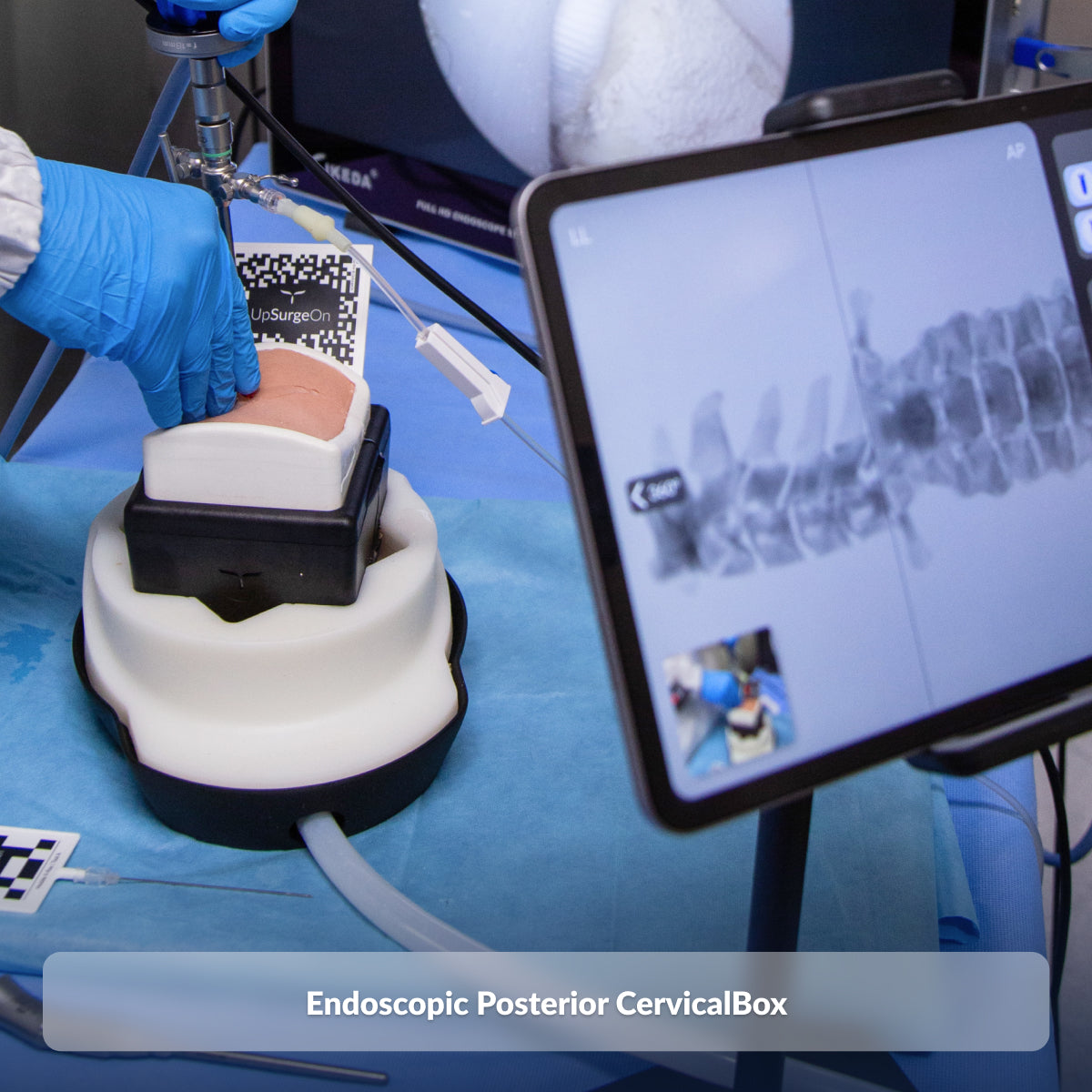 Endoscopic Posterior CervicalBox