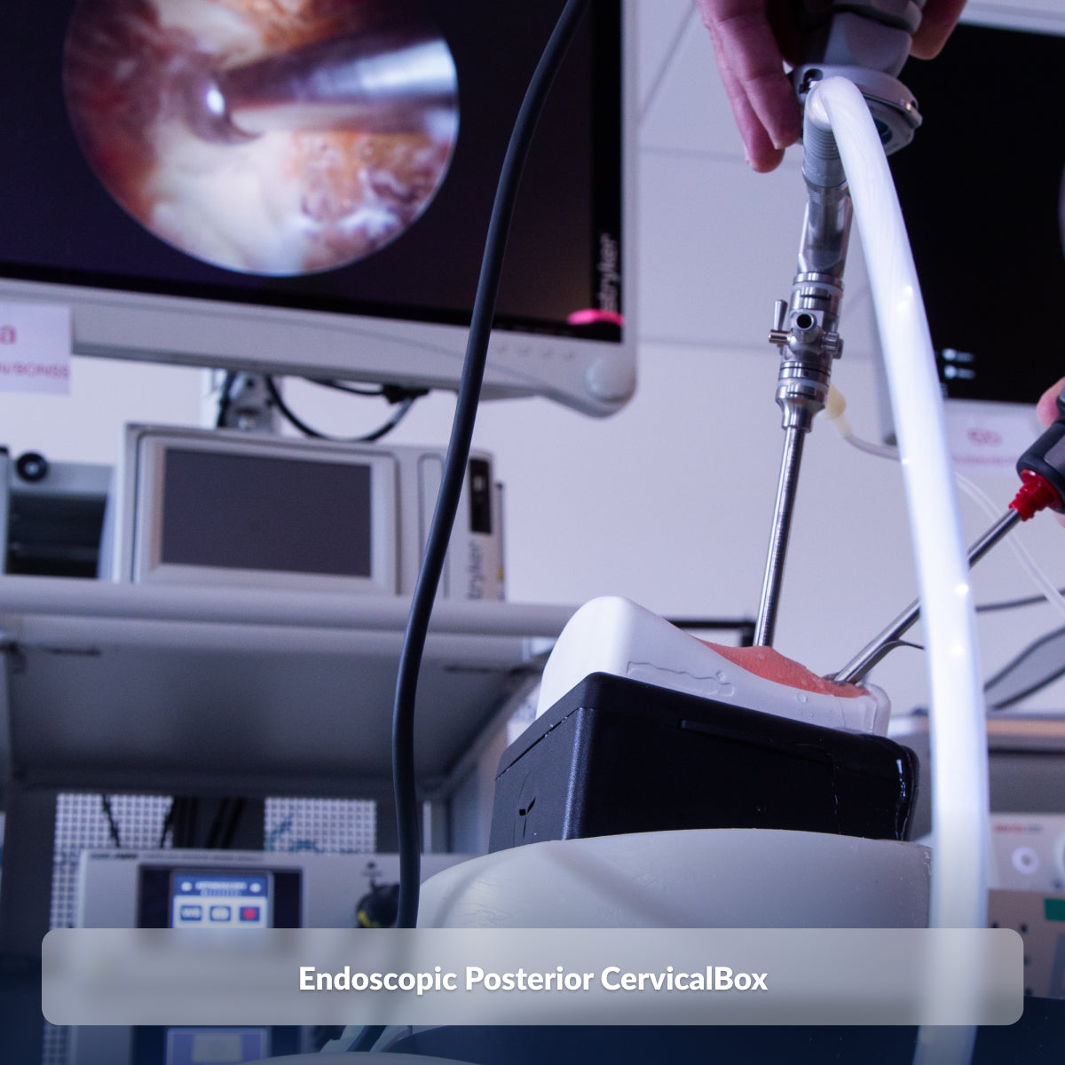 Endoscopic Posterior CervicalBox