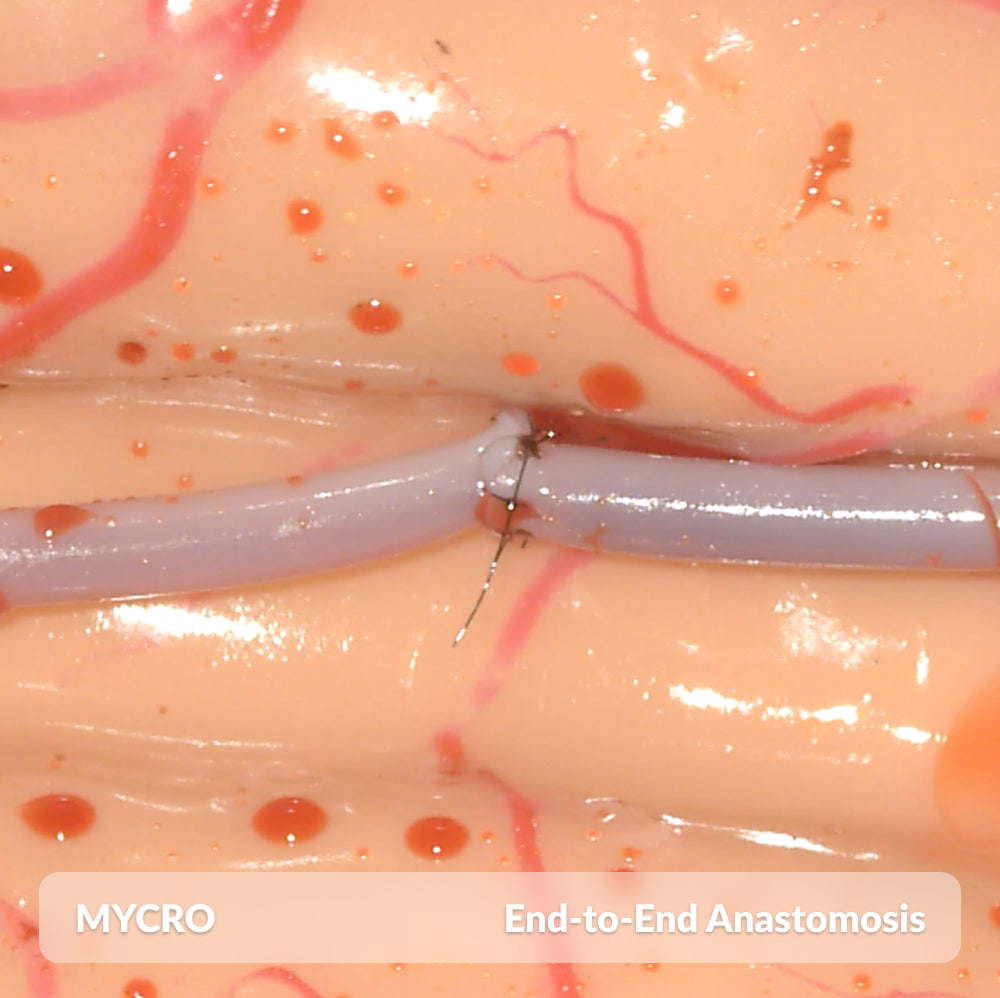 Mycro Full Kit with Loupes