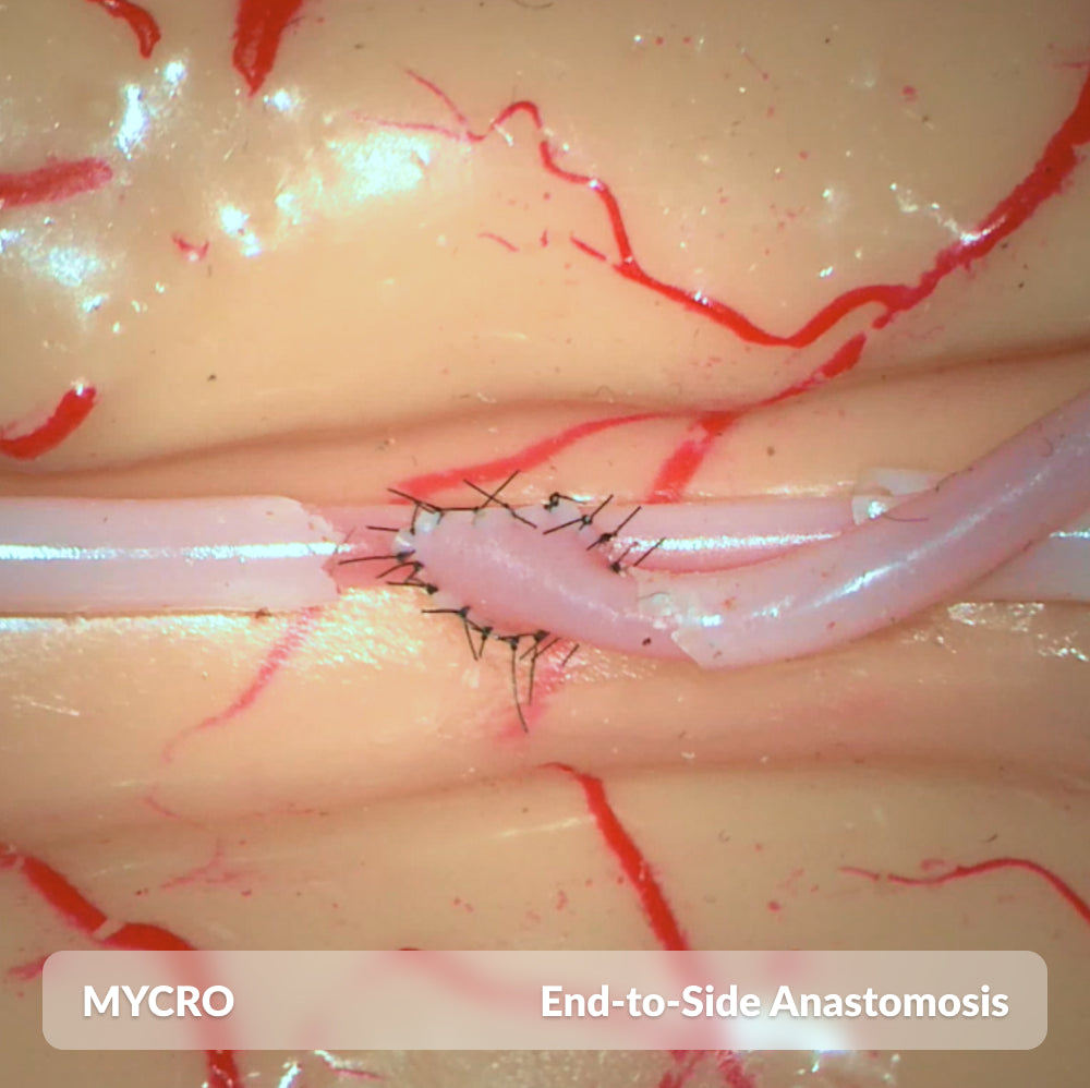 Mycro Full Kit with Loupes