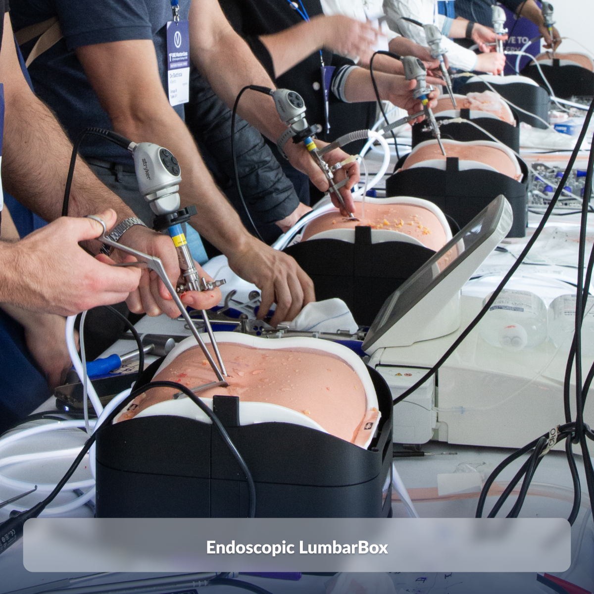 Endoscopic LumbarBox