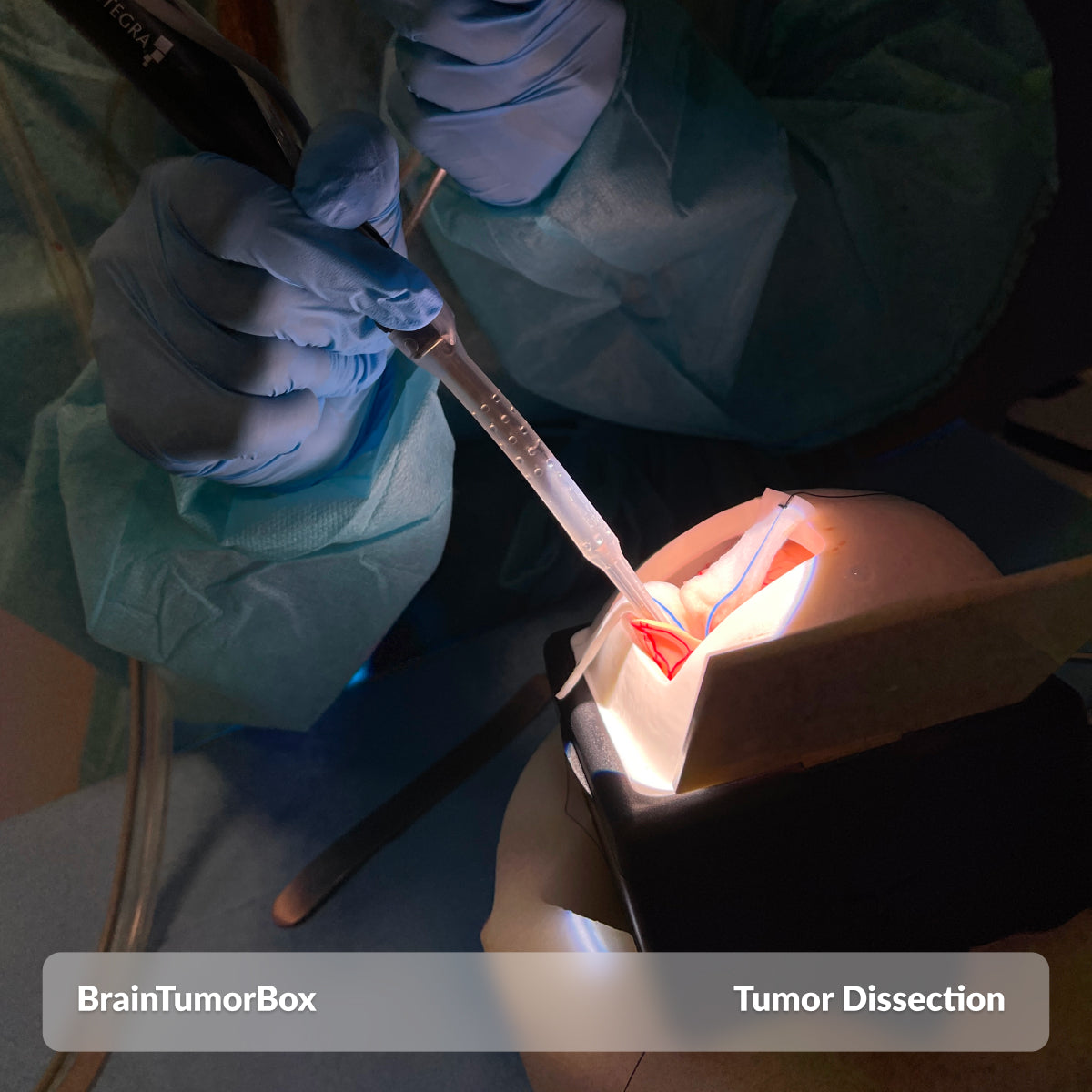 BrainTumorBox