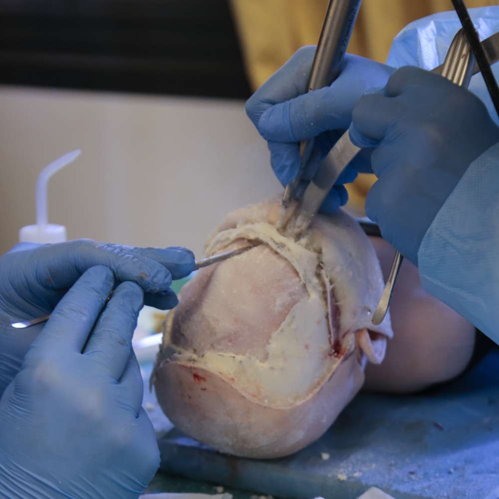 Paediatric Craniosynostosis