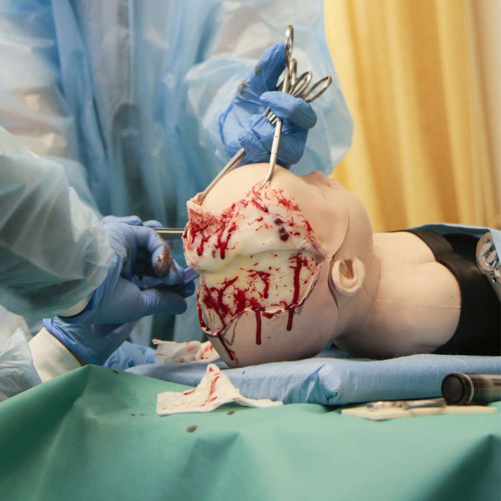 Paediatric Craniosynostosis