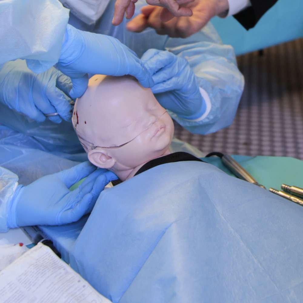 Paediatric Craniosynostosis