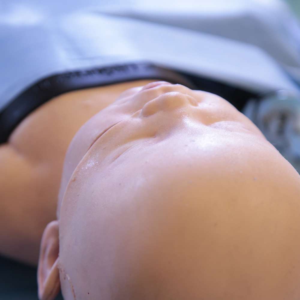 Paediatric Craniosynostosis
