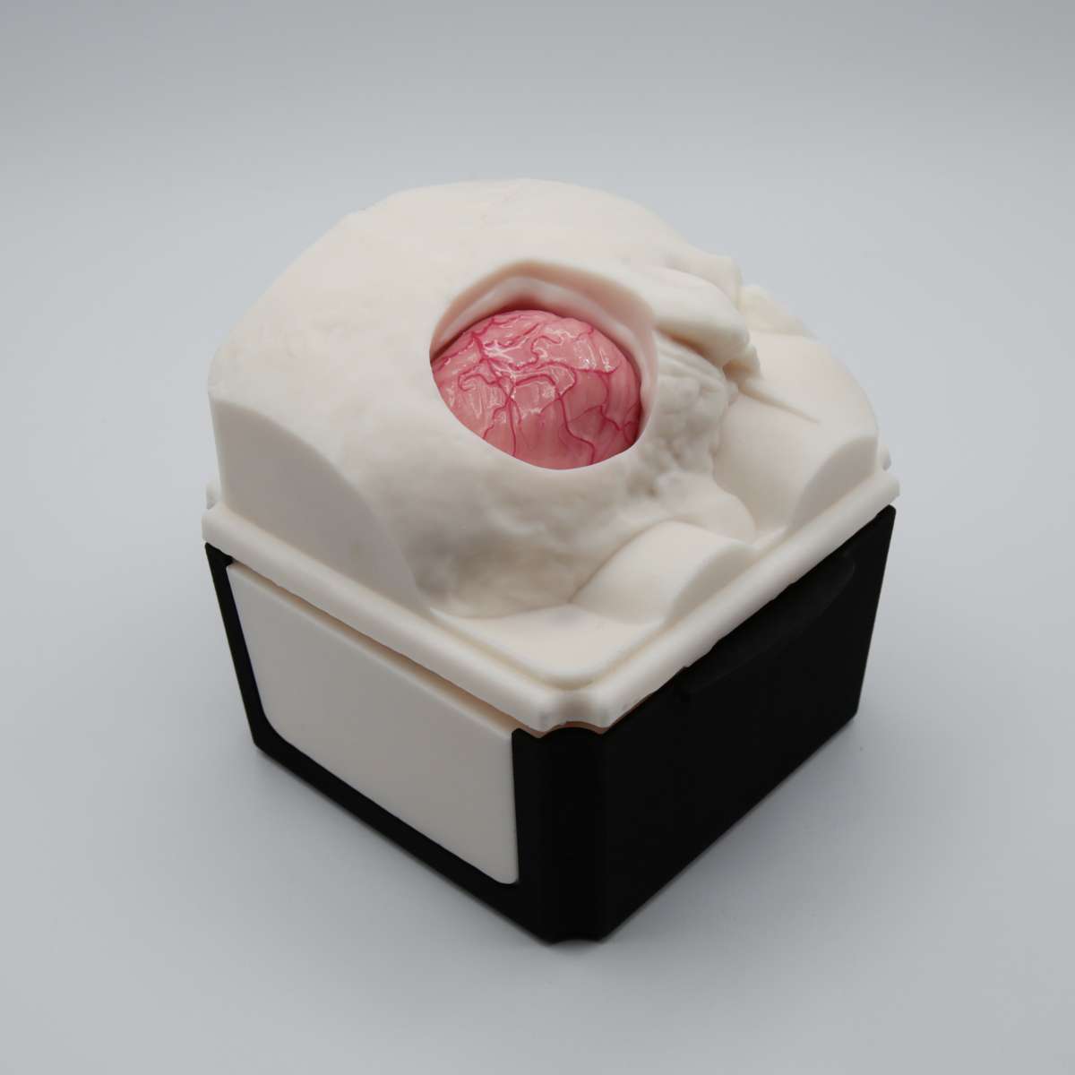 RetrosigmoidBox