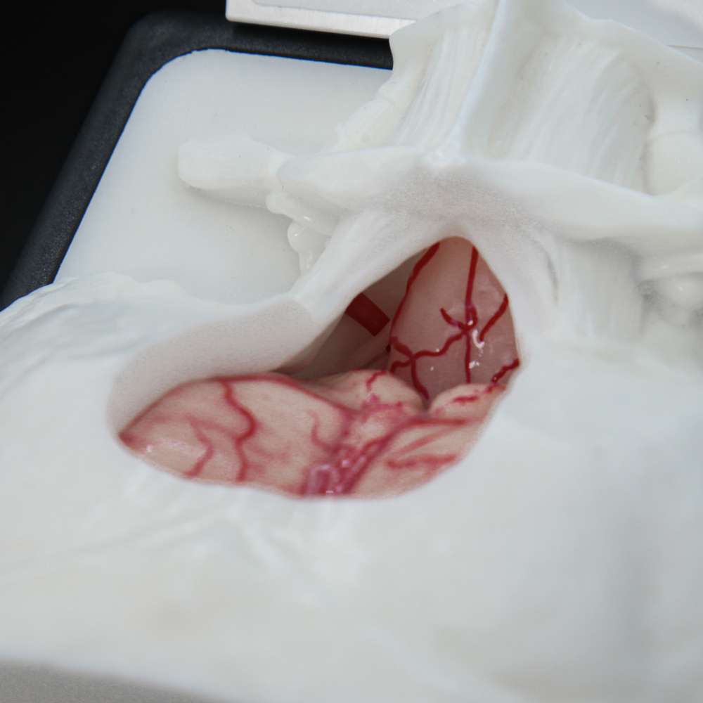 SuboccipitalBox