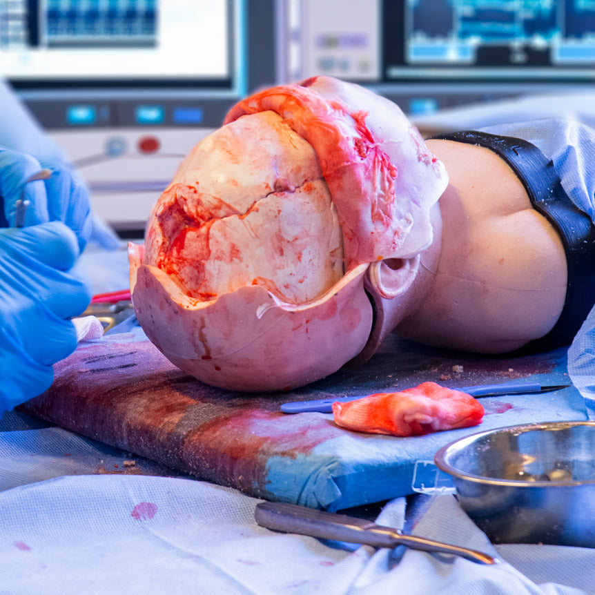 Paediatric Craniosynostosis