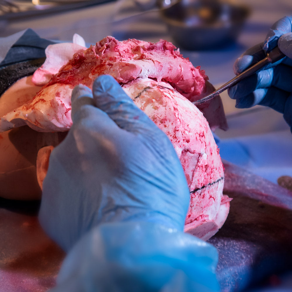 Paediatric Craniosynostosis