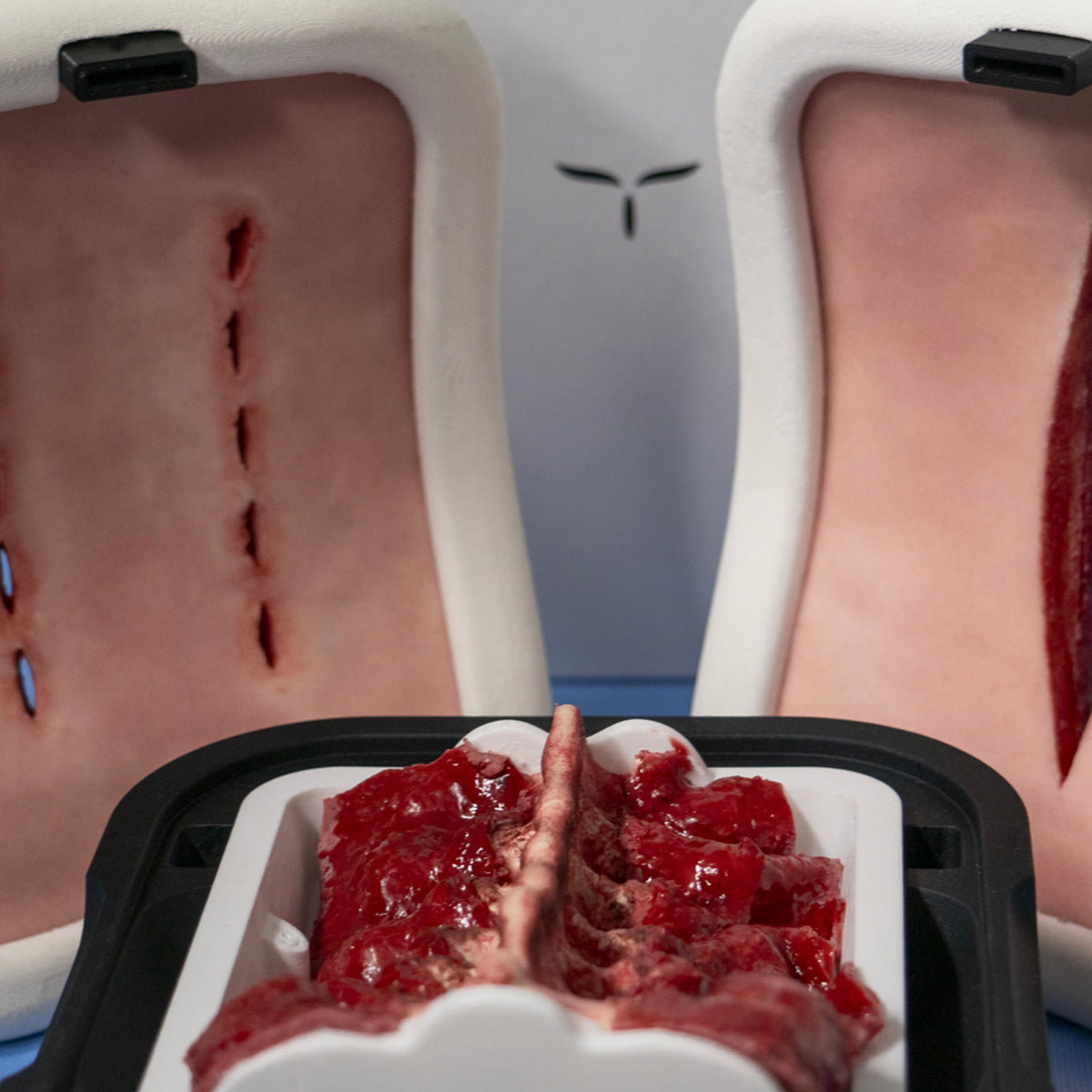 Posterior Lumbar Box