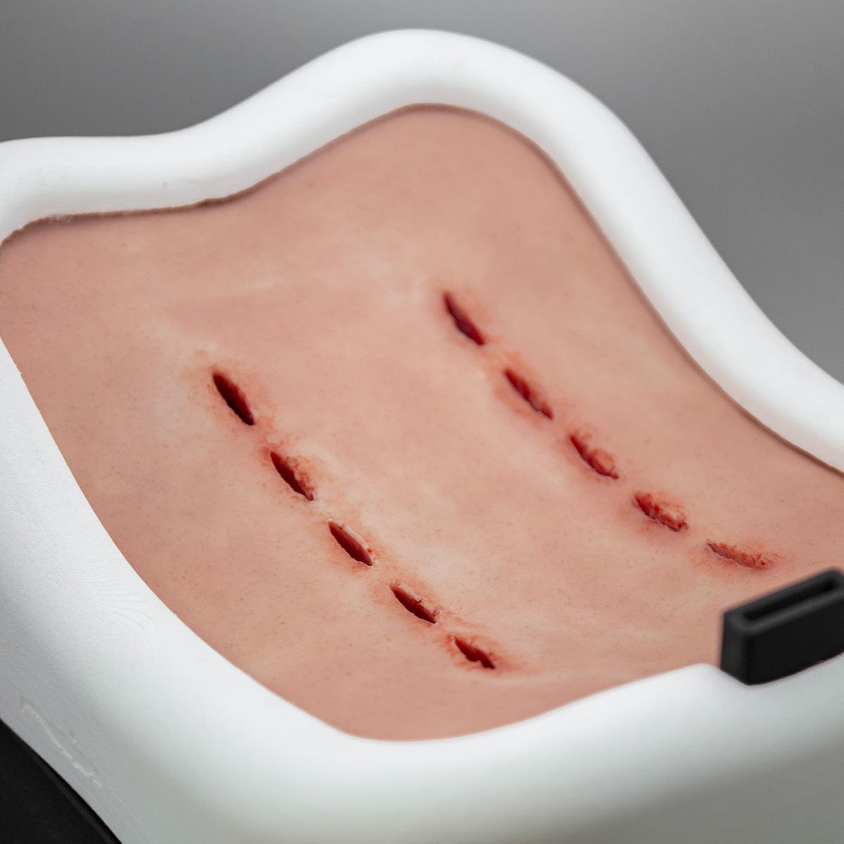 Posterior Lumbar Box