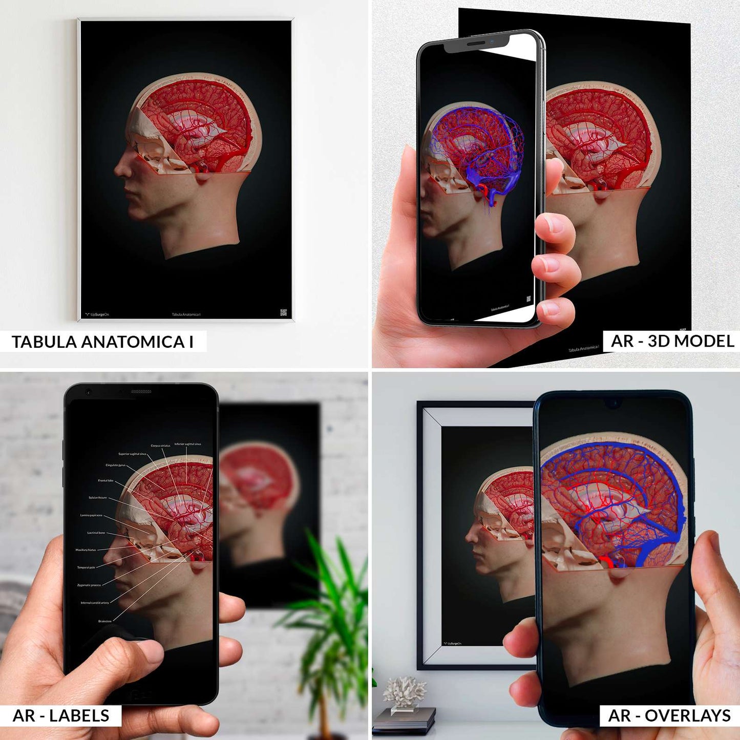 AnatomyARt Tabula Anatomica I
