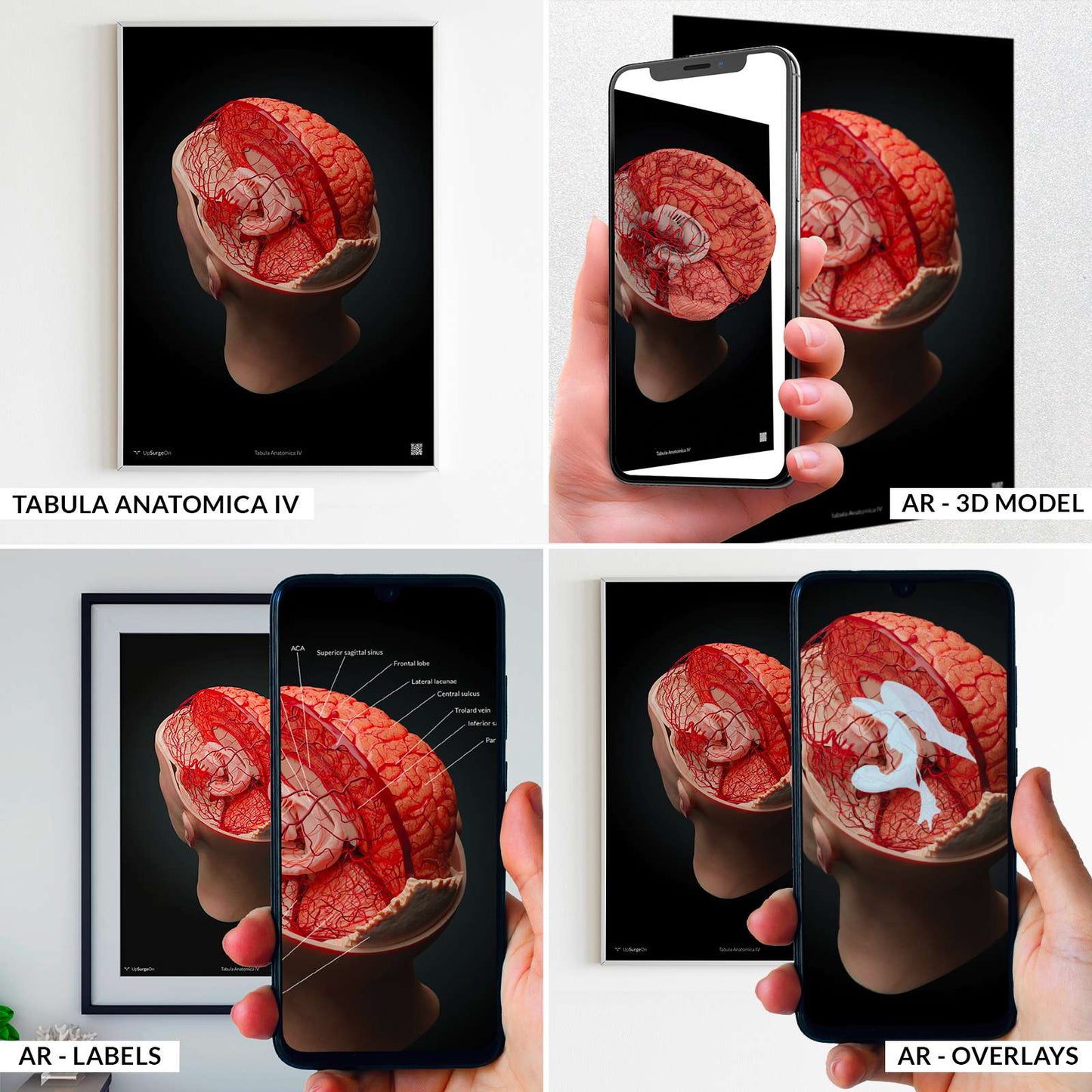 AnatomyARt Tabula Anatomica IV