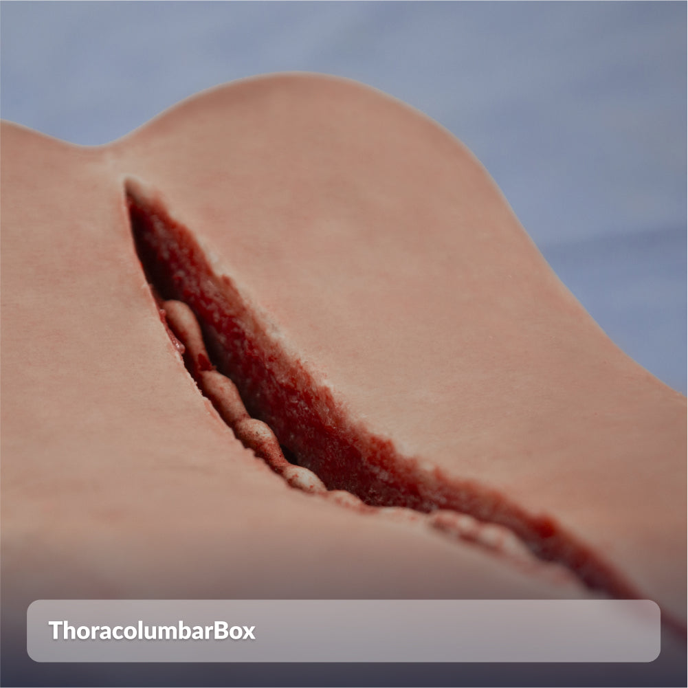 ThoracolumbarBox