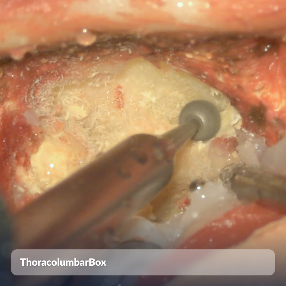 ThoracolumbarBox