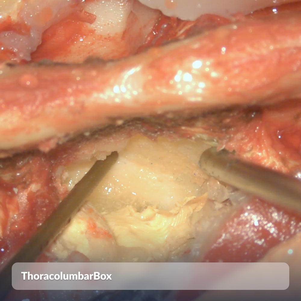 ThoracolumbarBox