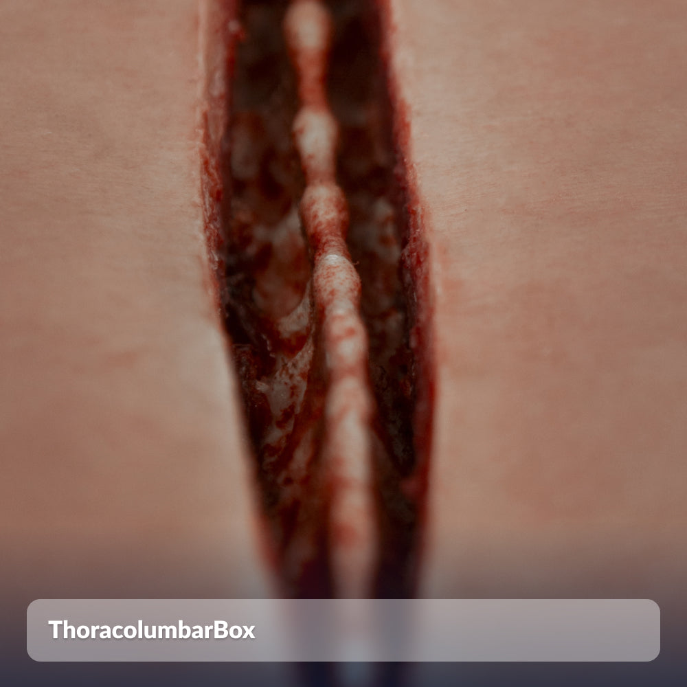ThoracolumbarBox