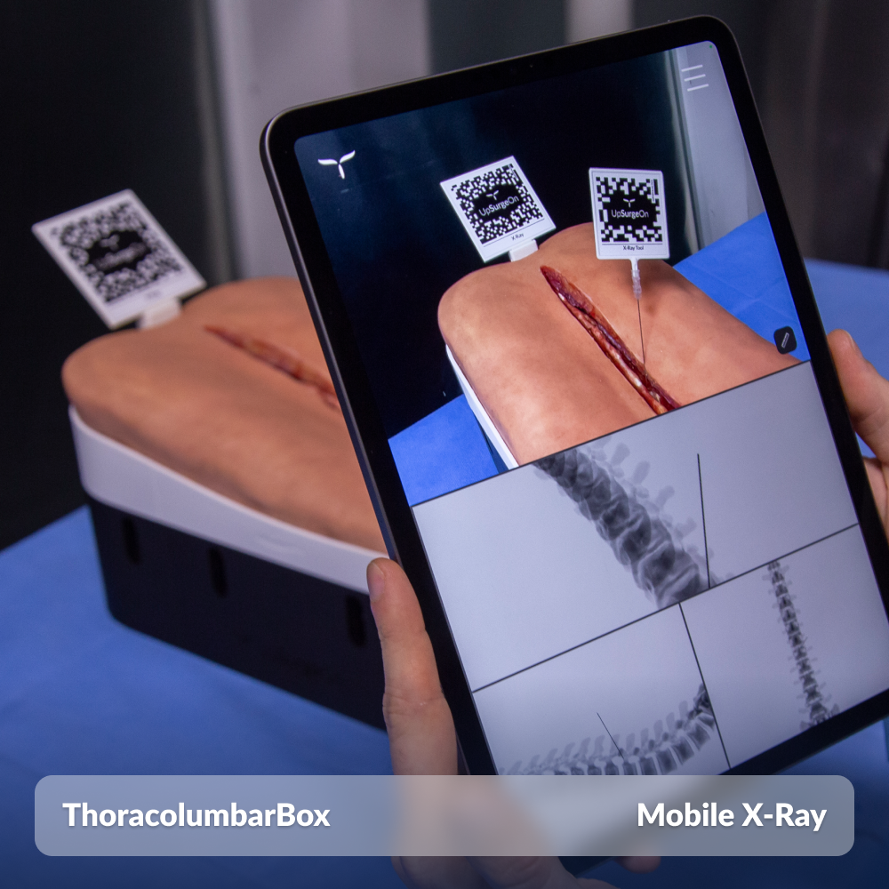 ThoracolumbarBox
