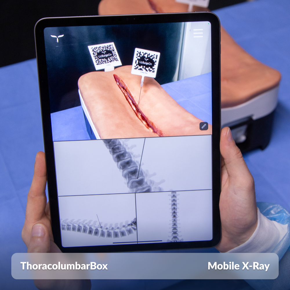 ThoracolumbarBox