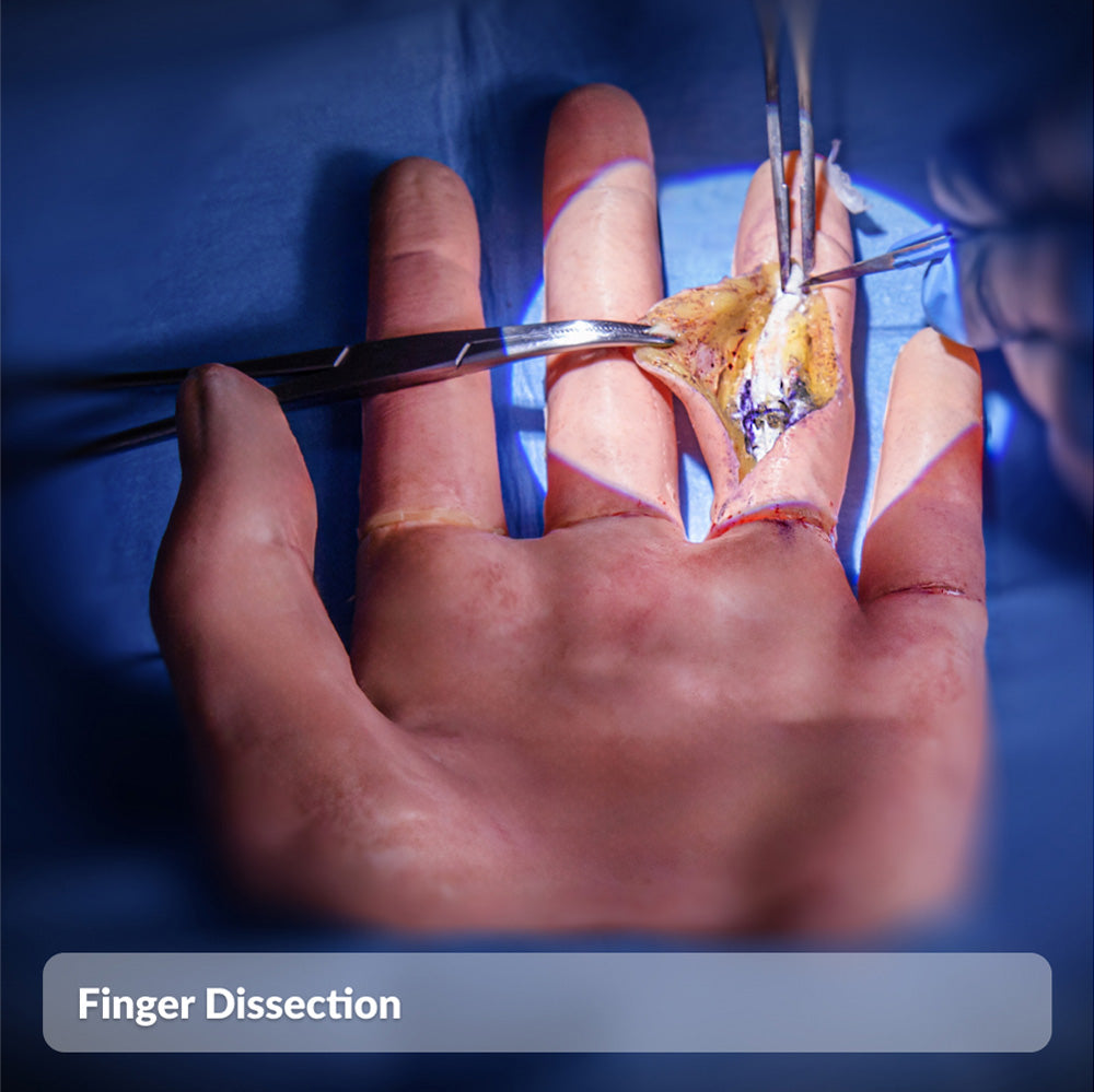 Finger Dissection