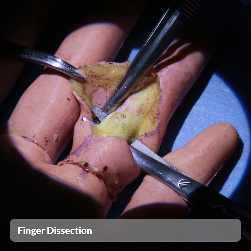 Finger Dissection
