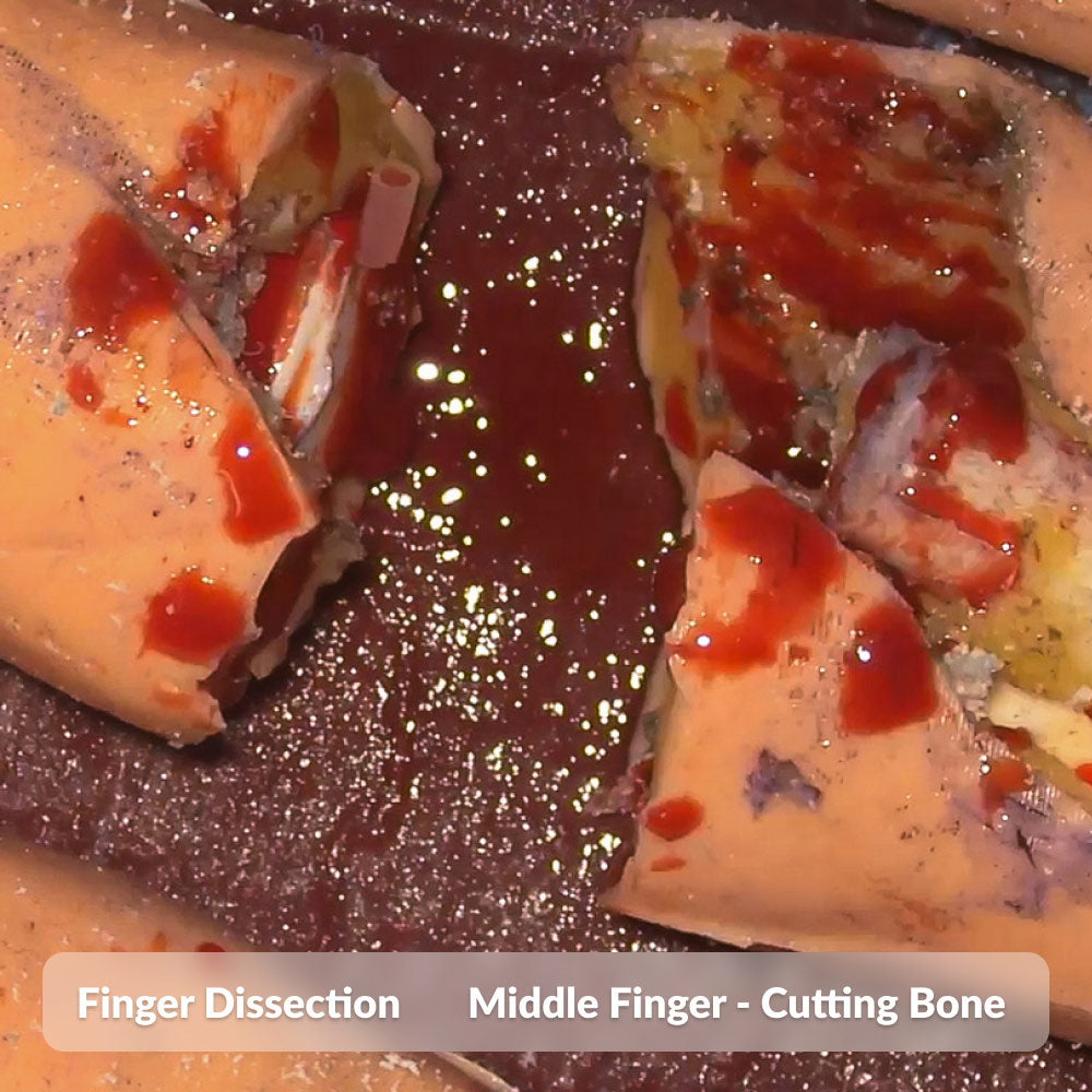 Finger Dissection