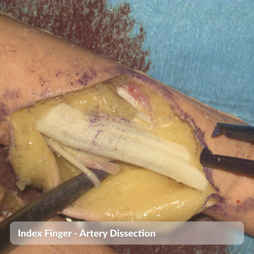 Finger Dissection