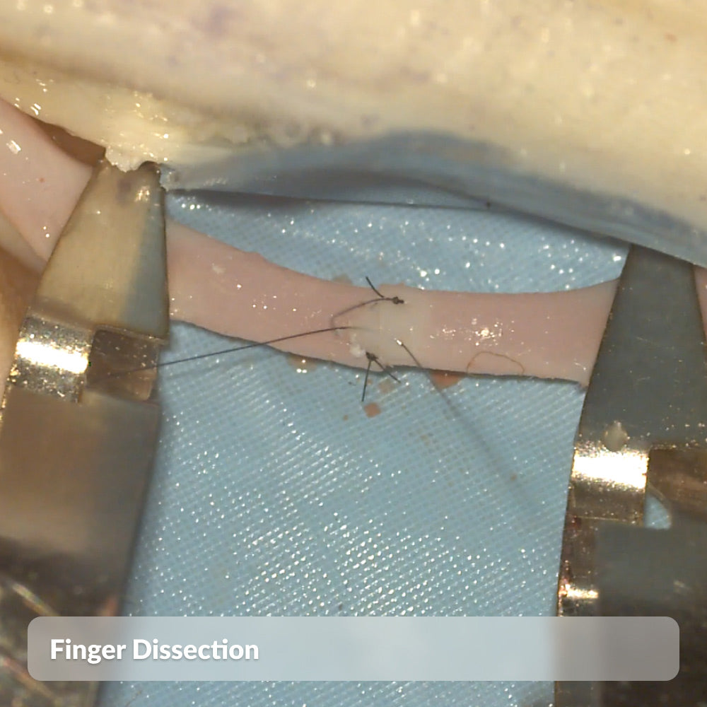 Finger Dissection