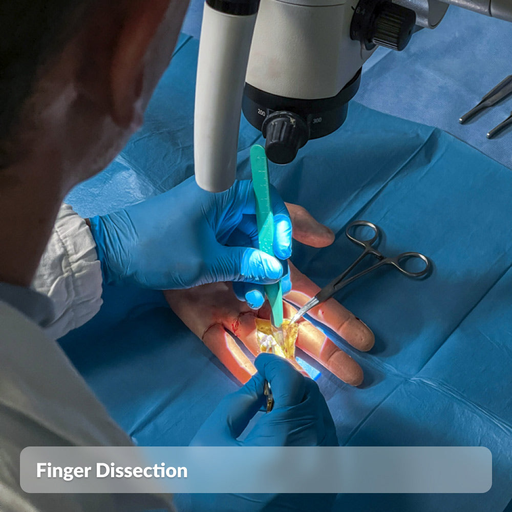 Finger Dissection