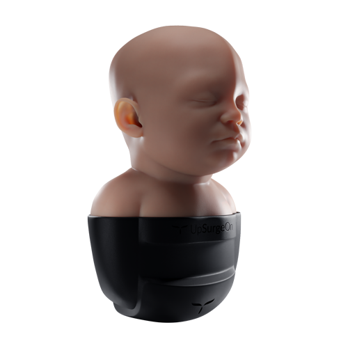 Paediatric Craniosynostosis