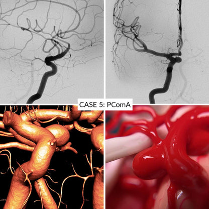 Aneurysm Training Kit