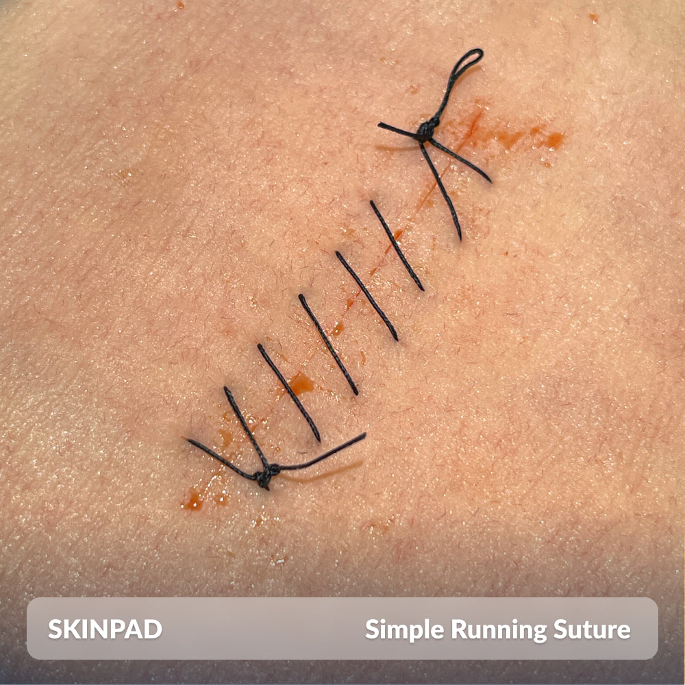 Skin suture shop