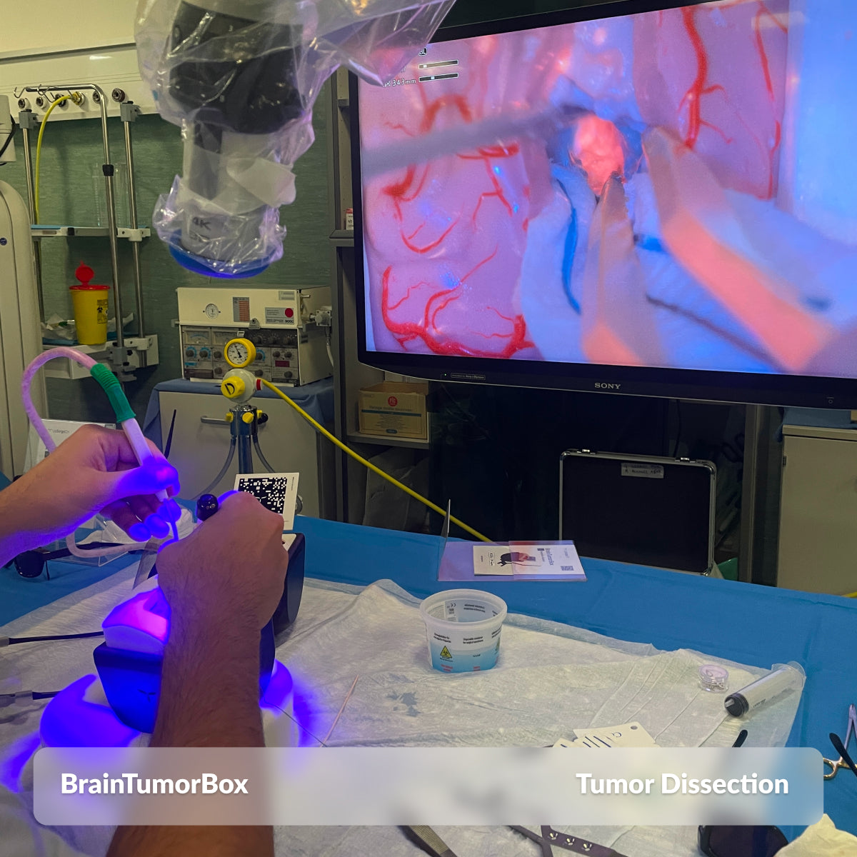 BrainTumorBox
